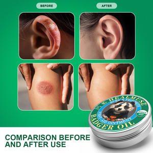 スミフン バジャー オイル 抗菌クリーム 外用 肌の抗菌作用とかゆみ止めクリーム - Product Image 4