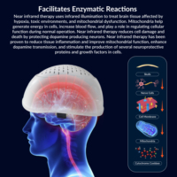 Casque de thérapie par lumière infrarouge 1070 nm PBM, stimulateur cérébral par neurofeedback pour la démence, Parkinson, la rééducation cognitive sportive