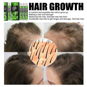 Spray de croissance des cheveux OEM de marque privée plus fort plus longtemps liquide anti-perte post-partum alopécie traitement de <span class=keywords><strong>la</strong></span> calvitie sérum capillaire - Product Image 3