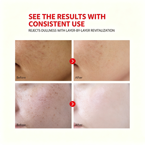 Sérum Visage au Glutathion, Acide Kojique, Vitamine C et Niacinamide – Essence Éclaircissante, Hydratante et Nourrissante pour Uniformiser le Teint et Atténuer les Taches Brunes - Product Image 2
