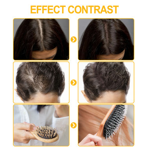OEM Boule de poils Solution de soins de massage hydratante Anti-chute de cheveux Stimulation de la naissance des cheveux Traitements de la repousse des cheveux - Product Image 5