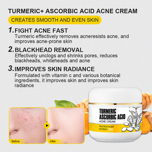 Crema facial de cúrcuma y vitamina C con ácido salicílico y <span class=keywords><strong>aloe</strong></span> <span class=keywords><strong>vera</strong></span> calmante Control de aceite calmante alivio del acné brillo OEM listo - Product Image 3