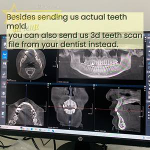 Fabrication de qualité supérieure <span class=keywords><strong>GRILLZ</strong></span> EXPERT MANUFACTURER Top 6 Bottom 6 Bijoux de rappeur <span class=keywords><strong>Grillz</strong></span> en diamant moissanite sur mesure taille princesse - Product Image 2