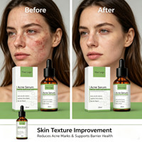 Sérum Visage en Gros OEM ODM Marque Privée Acide Salicylique Acide Azélaïque pour l'Équilibre du Sébum et les Soins de la Peau