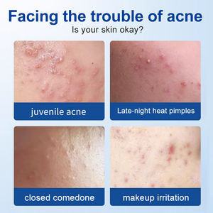 DERMFREE Tabletten/Box Salicylsäure Akne Patch Über nacht behandlung für zystische Pickel absorbiert flüssige Dehnung streifen creme - Product Image 3