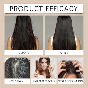 Suero para el Crecimiento del Cabello con Jengibre, Fo-Ti y Biotina para Combatir la Caída del Cabello, Cuidado del Cuero Cabelludo y Fortalecimiento Tónico para el Crecimiento Rápido y Saludable del Cabello - Product Image 3