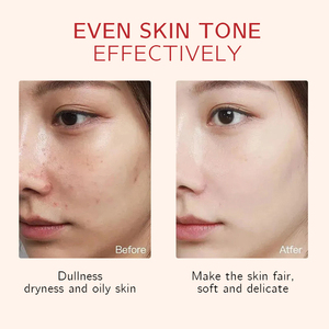 Hydrolat de néroli naturel, <span class=keywords><strong>eau</strong></span> de fleur d'oranger - Tonique facial rafraîchissant pour apaiser la peau - Product Image 4
