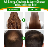 100% murni mendorong kesehatan rambut memperkuat meningkatkan minyak Batana rambut untuk pertumbuhan rambut
