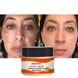 % 100% doğal kojik asit parlatma ve beyazlatma yüz kremi portakal kabuğu yağı <span class=keywords><strong>C</strong></span> vitamini koyu nokta kremi kaldırmak - Product Image 2