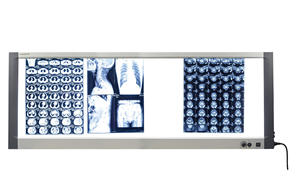 Kualitas tinggi penampil Film sinar X medis dengan dukungan sertifikasi CE ISO MG02 Panel ganda dengan saklar Sensor - Product Image 2