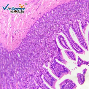 100 Stück menschliche Mikro fotografie Histologie vorbereitet Objektträger Set Proben Mikroskop vorbereitet Objektträger Histologie Objektträger - Product Image 5