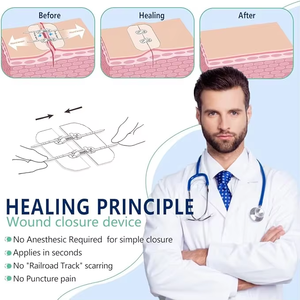 Apósito para cierre de heridas, Tira quirúrgica para cierre de heridas, Dispositivo de cierre de heridas, Tira de cierre de heridas - Product Image 6