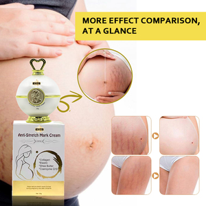 Crème <span class=keywords><strong>Anti</strong></span>-Vergetures 5D Gluta Élimination d'Huile Formée <span class=keywords><strong>Pommade</strong></span> Réparatrice de Cicatrices Massage Résultats Rapides - Product Image 3