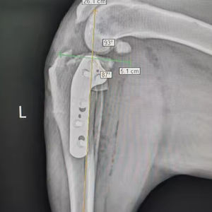 Set instrumen bedah, pelat pengunci dokter hewan 2.0/2.4/2.7/3.5mm pelat tulang pengunci Tplo - Product Image 6