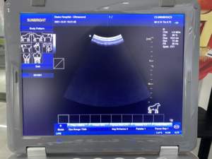 La machine portative d'ultrason de vétérinaire noir et blanc 15 pouces a mené le système d'imagerie diagnostique d'<span class=keywords><strong>Usg</strong></span> - Product Image 5