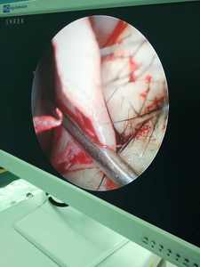 Caméra endoscopique hd, prix du fabricant de la caméra endoscopique <span class=keywords><strong>shrek</strong></span> - Product Image 6