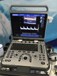 <span class=keywords><strong>Chison</strong></span> Ebit50 Instruments à ultrasons médicaux portables 4d, <span class=keywords><strong>Machine</strong></span> à ultrasons - Product Image 5