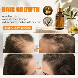 OEM/ODM Biotin Haarwuchs-Shampoo Sanfte Kopfhautreinigung Feuchtigkeitsspendend Glattes Glänzendes Haar Stärkung der Haarfollikel Haarpflege-Shampoo - Product Image 3