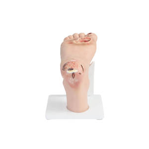 DARHMMY Alat Bantu Pengajaran Manekin Pencegahan Penyakit Kaki Diabetik - Model Gejala Ringan (PVC) untuk Pendidikan Pengasuh & Perawat - Product Image 4