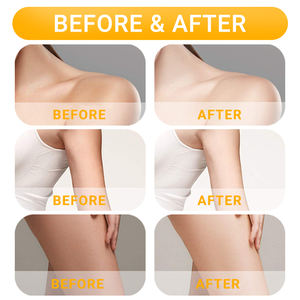 Miglior alleggerimento del limone della pelle 150ml olio per massaggio del corpo biologico naturale con odore dolce etichetta privata senza effetti collaterali - Product Image 2