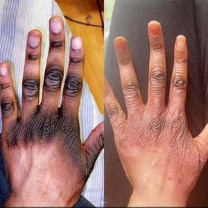 Meilleure Lotion Corporelle Éclaircissante Permanente Action Rapide pour Peau Noire Élimine les Taches Sombres sur les Articulations Genoux et Coudes - Product Image 3
