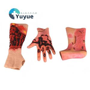 Modelo Realista de Piel con Simulación de Quemaduras <span class=keywords><strong>en</strong></span> Brazo, Mano <span class=keywords><strong>y</strong></span> Pierna para Entrenamiento de Primeros Auxilios - Product Image 1