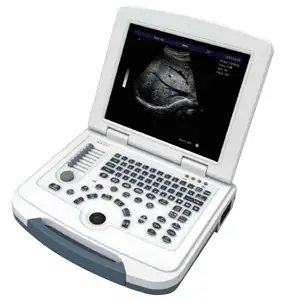 Tablette de couleur Portable, Machine à ultrasons Usg entièrement numérique Portable B/W Scanner à ultrasons pour humain