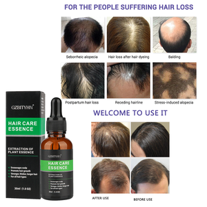 เซรั่มปลูกผมเร็วสูตรพรีเมียมจากธรรมชาติ ผลิตภัณฑ์สมุนไพรออร์แกนิคผสมน้ำมันขิง มะพร้าว และทีทรีออยล์ สำหรับซ่อมแซมเส้นผม (Private Label OEM) - Product Image 4