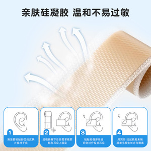 Chenkang Silicone Gel Ear Tape For Babies 4x50cm Medical Grade Gentle Adhesive Correcting Tape - Product Image 2