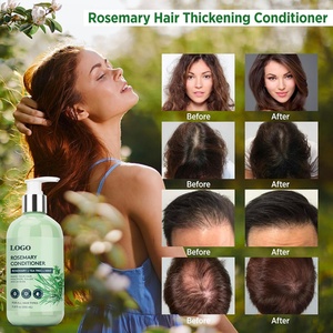 Acondicionador de Romero Orgánico con Logotipo Personalizado OEM, Crema Hidratante para Fortalecer el Cabello, Reducir la Rotura y Promover el Crecimiento del Cabello - Product Image 6