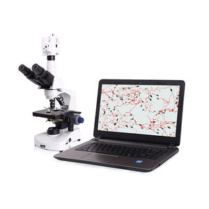 محلل الحيوانات المنوية محلل جودة الحيوانات المنوية - Product Image 6