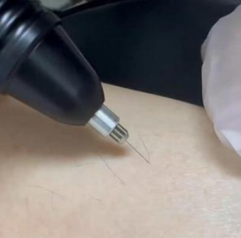 Nouvelle Machine Électronique Professionnelle 2026 pour l'Épilation Permanente par Électrolyse, Épilateur Électrique à Aiguille pour Élimination de Tous les Types de Poils - Product Image 3