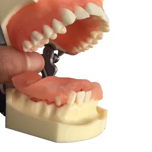 Soft Gum Mild Periodontal Dental Model Can Be Removed and Changed