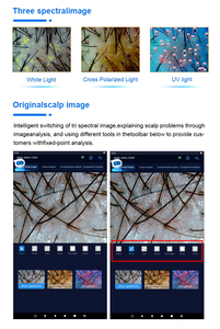 Machine d'analyse cutanée professionnelle 30MP avec rapport IA, prix usine 2026 - Product Image 5