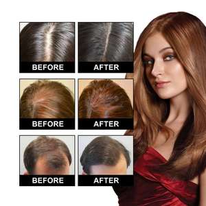 OUHOE Grosir Label Pribadi Menutrisi Kulit Kepala Merangsang Pertumbuhan Rambut Meningkatkan Kepadatan Rambut Minyak Esensial Pertumbuhan Rambut 30Ml - Product Image 2