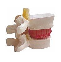 Ayuda para enseñanza biológica, anómicas vértebras lumbares, humanos, degenerativas, modelo de columna vertebral, Color blanco