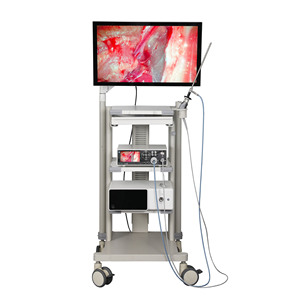 Macchina fotografica ad alta definizione di endoscopia per <span class=keywords><strong>Imaging</strong></span> medico per la chirurgia generale di ginecologia ENT - Product Image 2