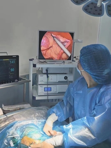 Equipo de imagen médica para endoscopio, laparoscopio, histeroscopia, uroología, 720P, aprobado por la CE - Product Image 6
