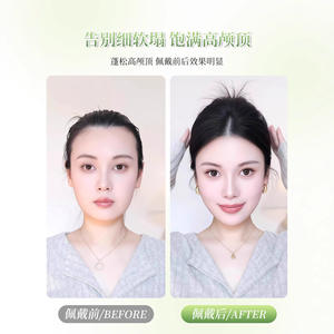 Prótesis Capilar de Corona Alta Da Guangming Negra Lisa con Encaje Superior para Reemplazo y Aumento de Volumen con Relleno Invisible - Product Image 4