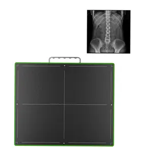 Medical x-ray equipments & accessories Wireless and Wired Flat Panel Detector Digital Radiography DR 14*17"