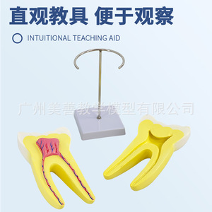 Modèle de molaires humaines agrandies, démontable en 2 parties, anatomie dentaire, jouet, outil pédagogique pour la maternelle, démonstration dentaire. - Product Image 2