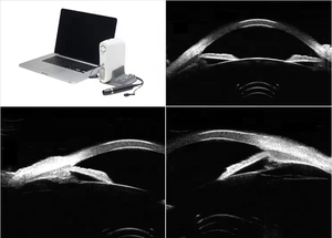 Alat Pemindai Ultrasonografi Mata Skala Penuh SW-3200S (UBM) (A/B/P/UBM) Pachymeter Biometer Portabel UBM - Product Image 5