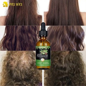 Huile de ricin noire biologique de la Jamaïque Huile de ricin naturelle pure en vrac pressée à froid pour les cils, les <span class=keywords><strong>sourcils</strong></span> et la croissance des cheveux - Product Image 4