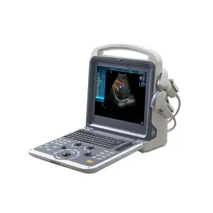 Klinik için 10G bellek renkli Doppler ultrason makinesi dizüstü ultrason makinesi