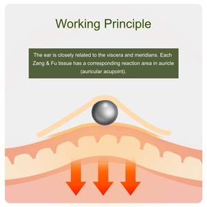 कान के बीज एक्यूपंक्चर किट आराम आपकी सुंदरता का समर्थन करने के लिए आसान है - Product Image 6
