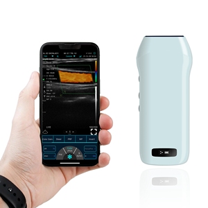 Konted مسبار الموجات فوق الصوتية المحمول Usb مسبار لاسلكي - Product Image 1