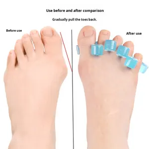 M字型外反母趾矯正用つま先セパレーター SEBS素材 四穴デザイン 男女兼用 トングサンダル風 メモリーフォームインソール - Product Image 2