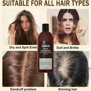 Shampoo Antiforfora al <span class=keywords><strong>Solfuro</strong></span> <span class=keywords><strong>di</strong></span> <span class=keywords><strong>Selenio</strong></span> 1% a Marchio Privato con 11 Estratti Botanici per il Controllo della Caduta dei Capelli e il Trattamento del Cuoio Capelluto Pruriginoso - Product Image 3