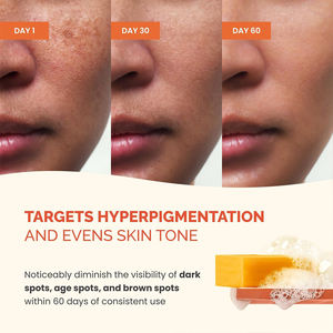 Savon au Curcuma Fait Main pour le Corps – Nettoyant Éclaircissant pour Aisselles Foncées, Jambes et Corps – Savon Visage Illuminateur pour une Peau Douce et Saine – Soin de Beauté - Product Image 5