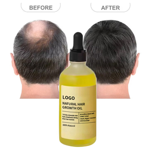 Olio per la Crescita dei Capelli 100% Naturale Private Label, Siero di Ricino e Mandorle, Rosmarino Selvatico Puro ad Azione Rapida con Menta Piperita - Product Image 2